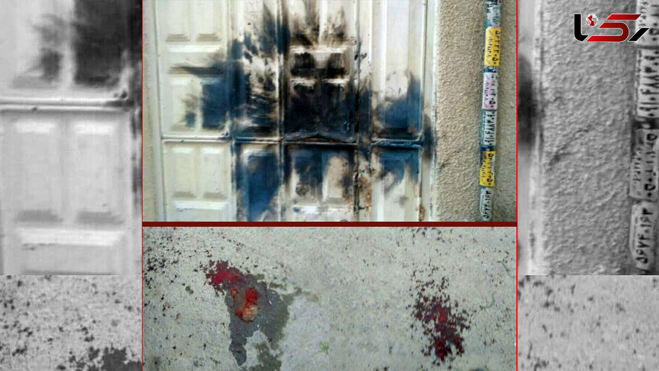 عکس انگشت قطع شده جوان گرگانی در انفجار ترقه 