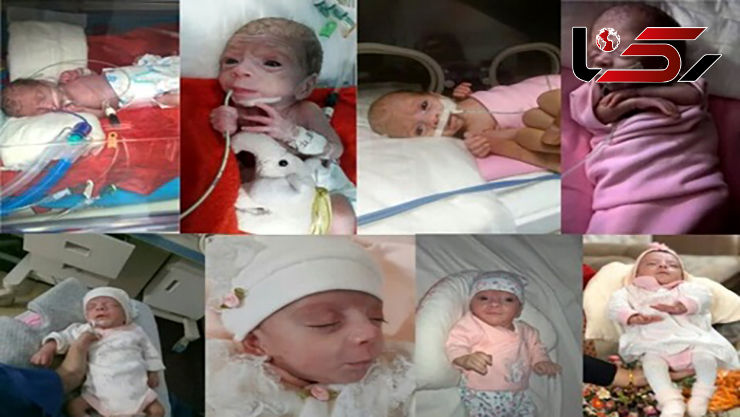 ماجرای تولد نوزاد نیم کیلویی در قم+ عکس عجیب
