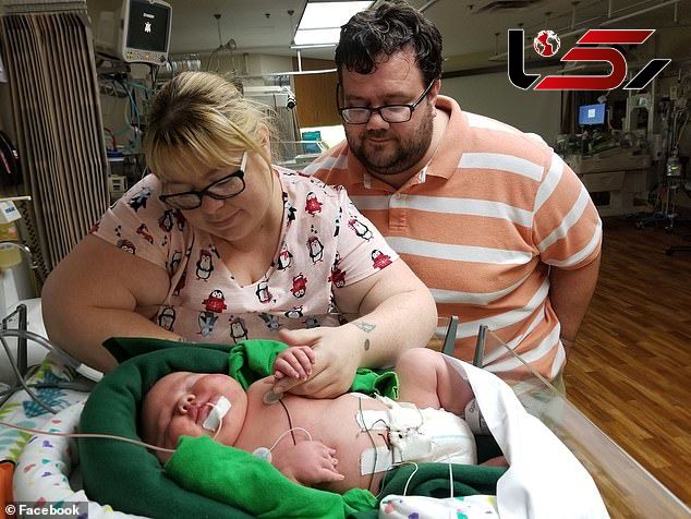 به دنیا آمدن این نوزاد همه را شگفت زده کرد+ عکس