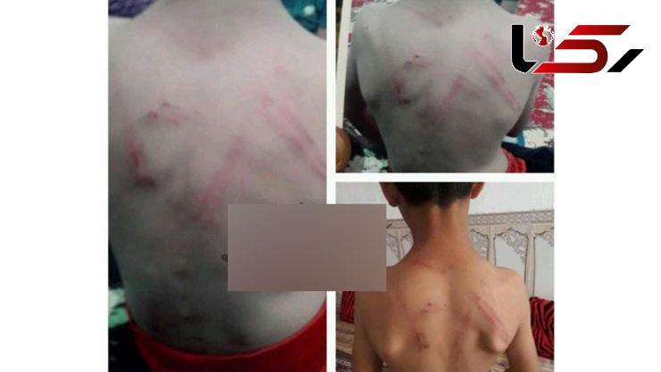 تصاویر دردناک از شکنجه هولناک یک کودک توسط معلم خوزستانی
