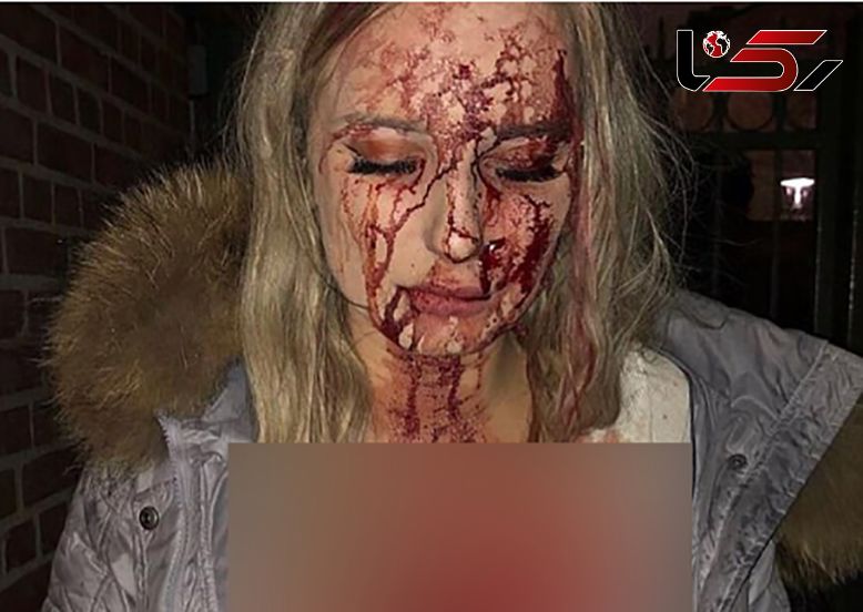 آزار و اذیت دختر 19 ساله در پارتی شبانه / مرد شرور فرار کرد + عکس 