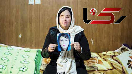 آخرین گفتگو با سهیلا جورکش/ بینایی چشم چپم را با روش جراحی نوین به دست آوردم + عکس